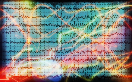 Onanieren kann epileptische Anfälle provozieren