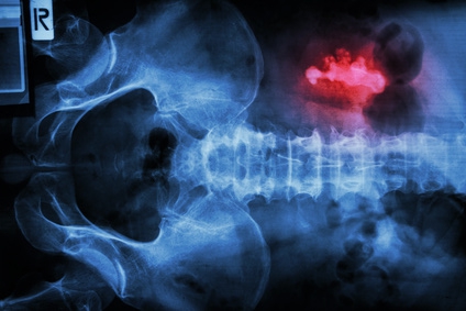 © stockdevil - Fotolia.com