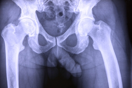 © Herby (Herbert) Me - Fotolia.com